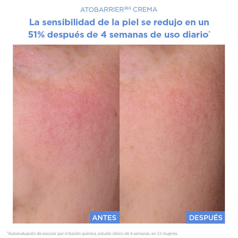 ATOBARRIER365 CREAM (CREMA HUMECTANTE REPARADORA)